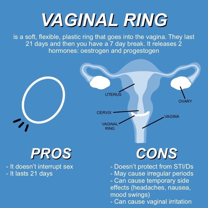 What you should know about Phexxi birth control gel